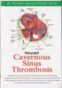 Penyakit Cavernous Sinus Thrombosis